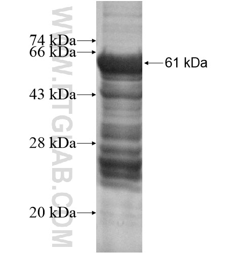 ZNF625 fusion protein Ag14758 SDS-PAGE ZNF625 fusion protein Ag14758 SDS-PAGE
