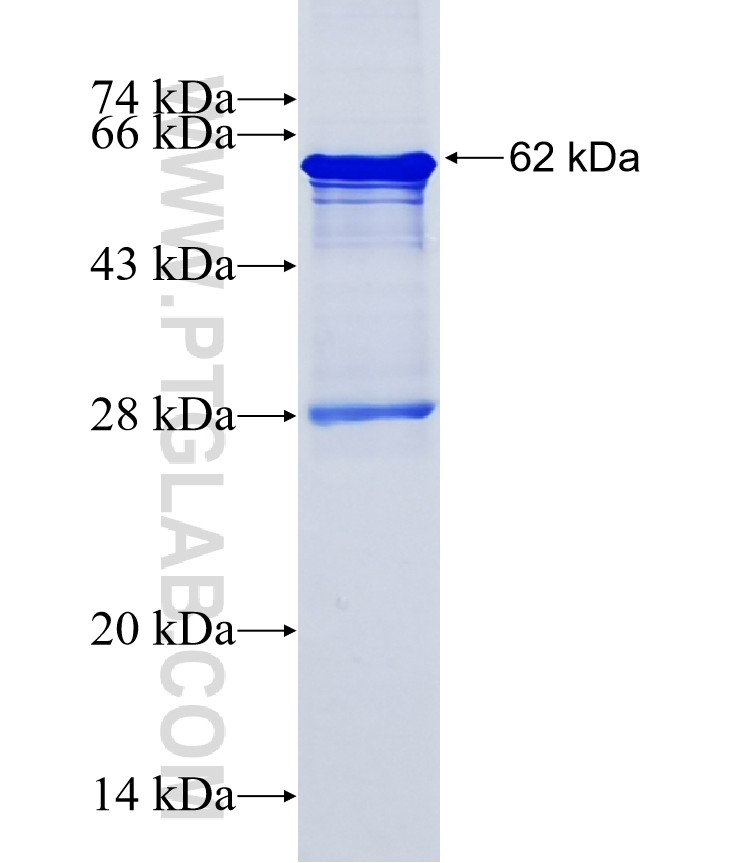 ZNF627 fusion protein Ag15048 SDS-PAGE ZNF627 fusion protein Ag15048 SDS-PAGE