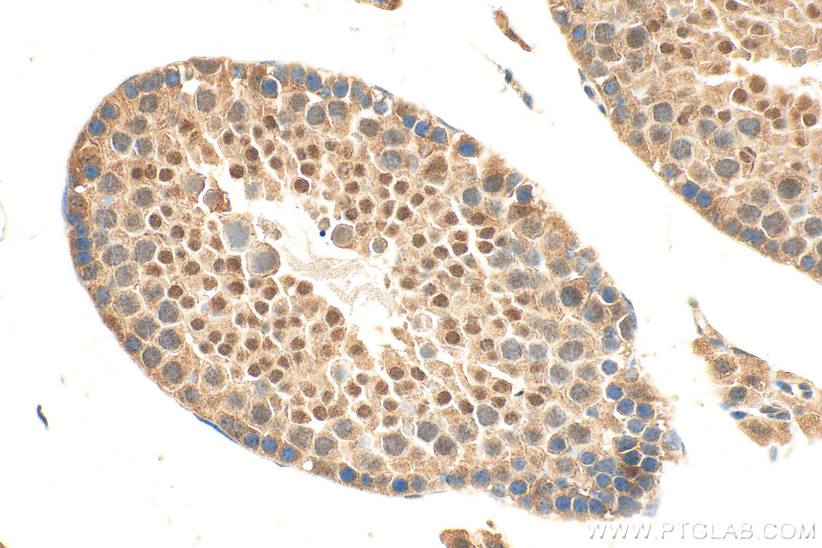 Immunohistochemical analysis of paraffin-embedded mouse testis tissue slide using 25817-1-AP (ZNF639 antibody) at dilution of 1:1000 (under 40x lens). Heat mediated antigen retrieval with Tris-EDTA buffer (pH 9.0). IHC staining of mouse testis using 25817-1-AP