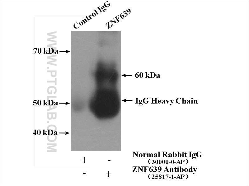 IP experiment of HeLa using 25817-1-AP