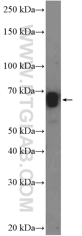 ZNF639