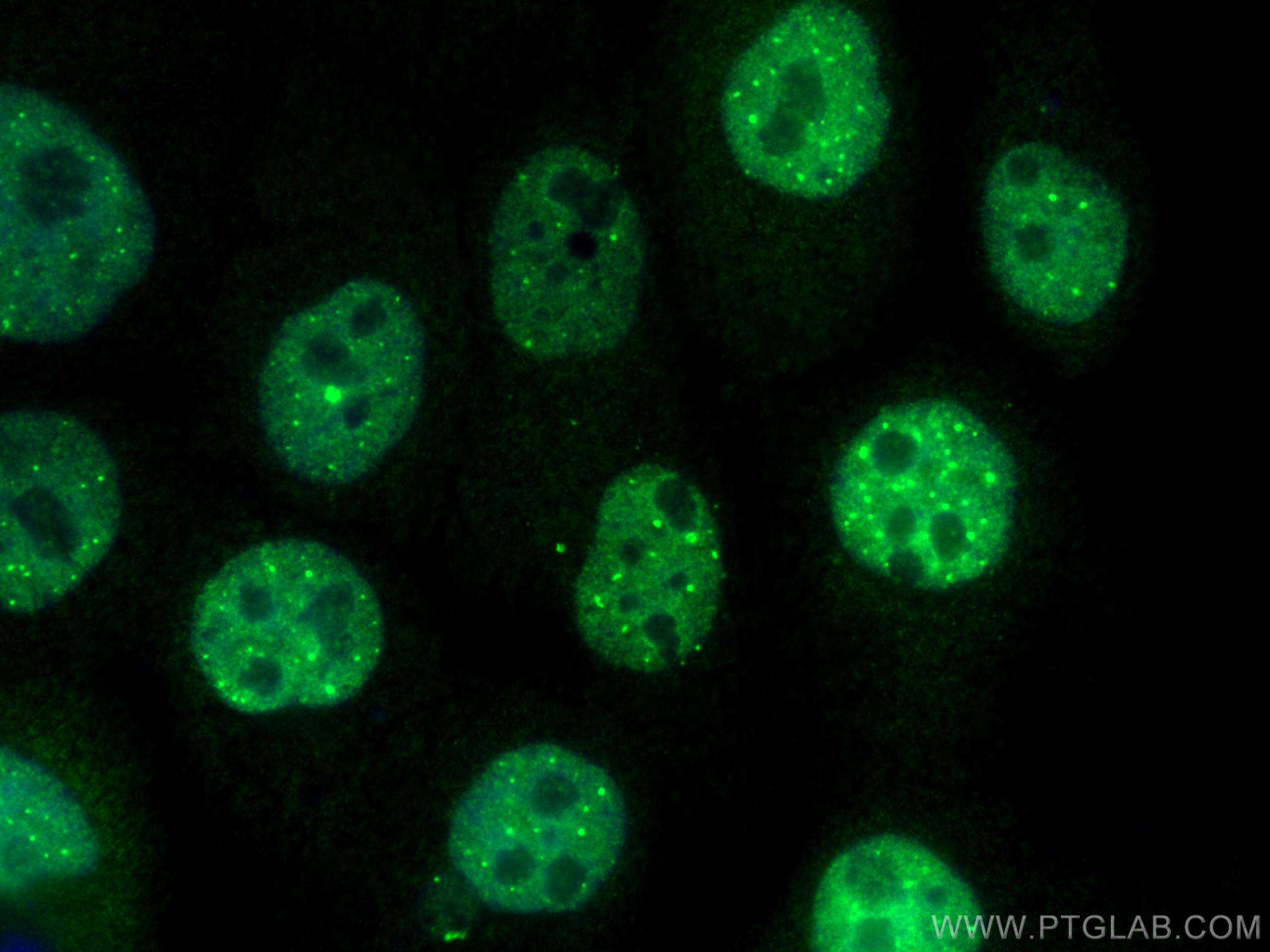 IF Staining of A431 using 26302-1-AP