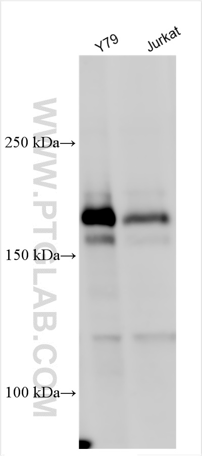 WB analysis using 25956-1-AP (same clone as 25956-1-PBS)