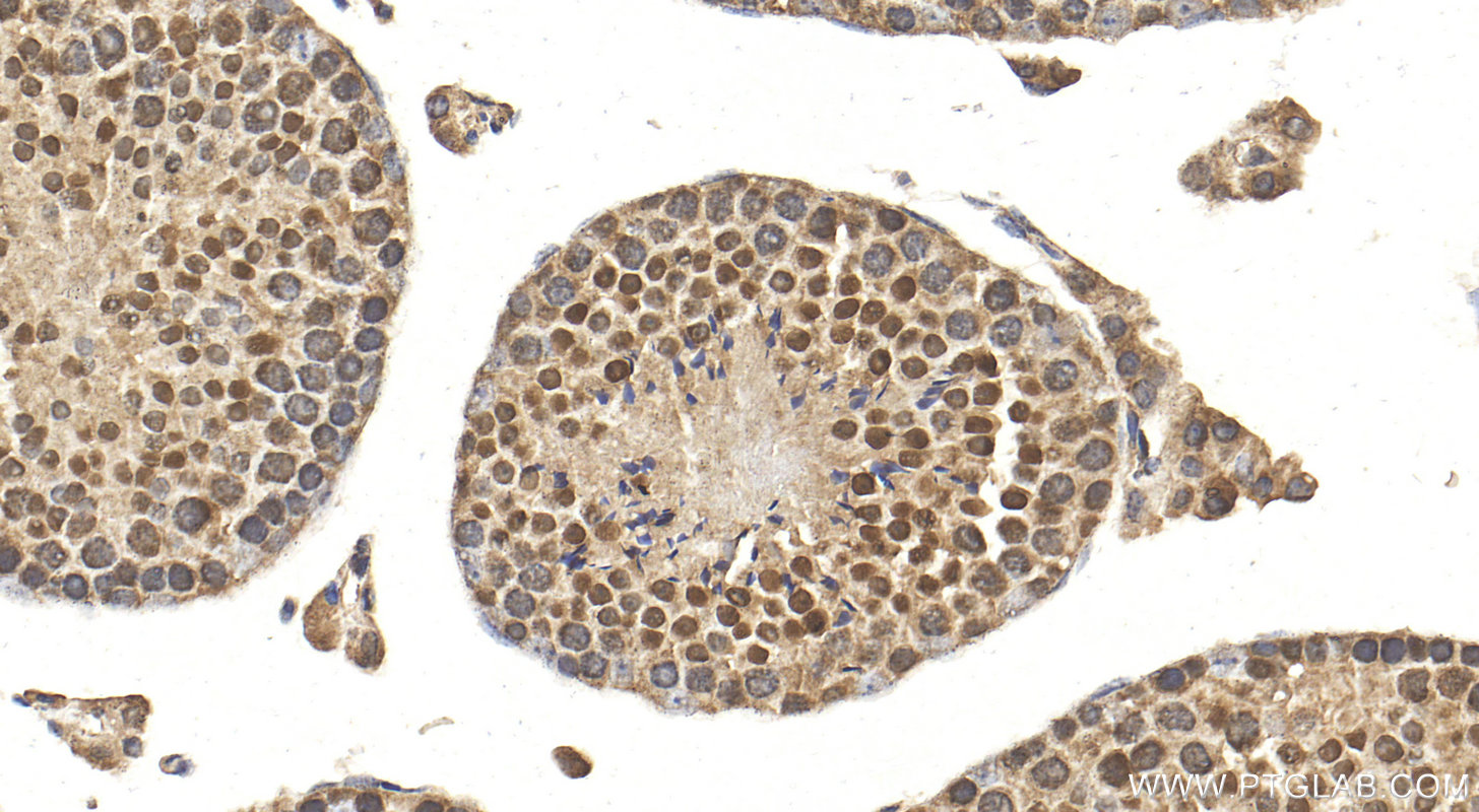IHC staining of mouse testis using 27590-1-AP