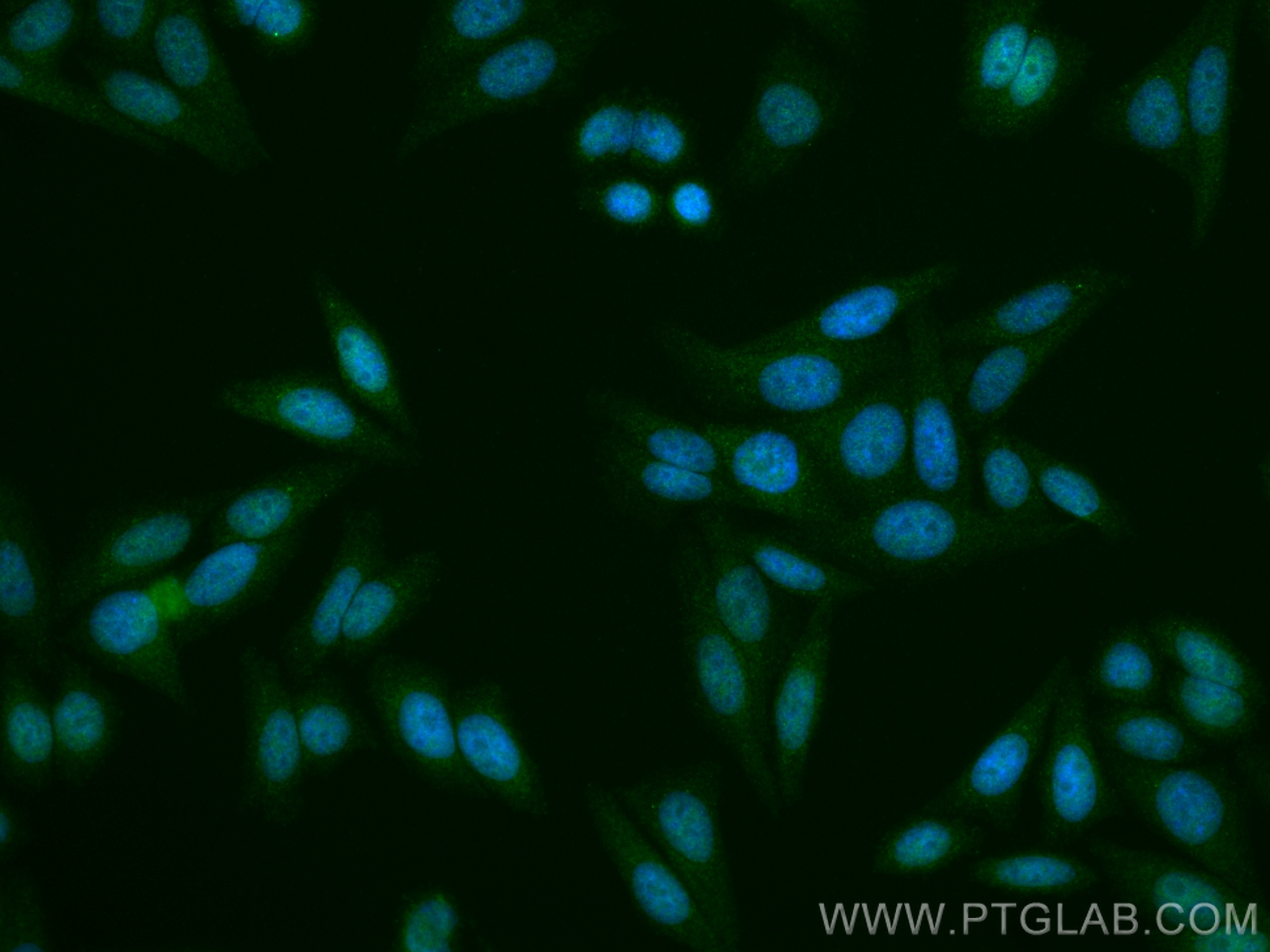 IF Staining of HepG2 using 24596-1-AP