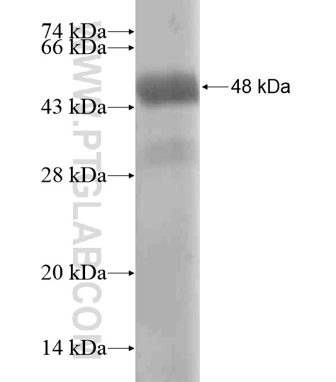 ZNF654 fusion protein Ag20226 SDS-PAGE ZNF654 fusion protein Ag20226 SDS-PAGE