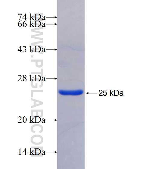 ZNF658 fusion protein Ag20520 SDS-PAGE ZNF658 fusion protein Ag20520 SDS-PAGE