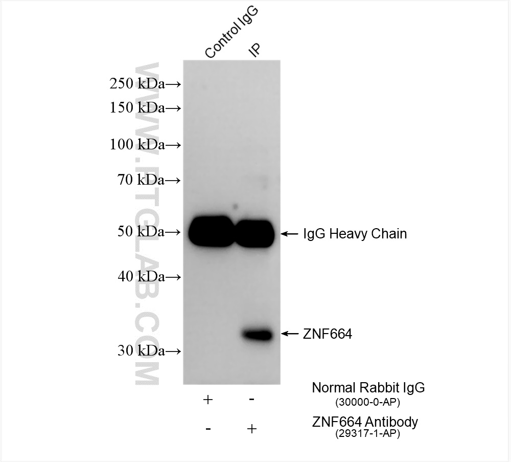 IP experiment of mouse liver using 29317-1-AP