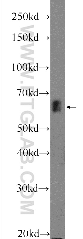 WB analysis of COLO 320 using 25669-1-AP (same clone as 25669-1-PBS)