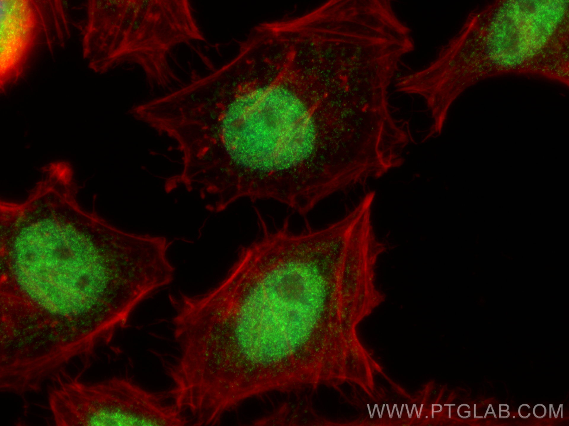 IF Staining of HeLa using 25794-1-AP
