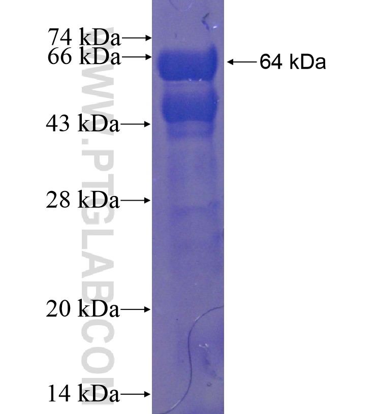 ZNF687 fusion protein Ag16264 SDS-PAGE ZNF687 fusion protein Ag16264 SDS-PAGE