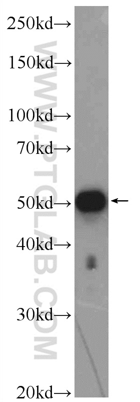 WB analysis of HeLa using 25573-1-AP
