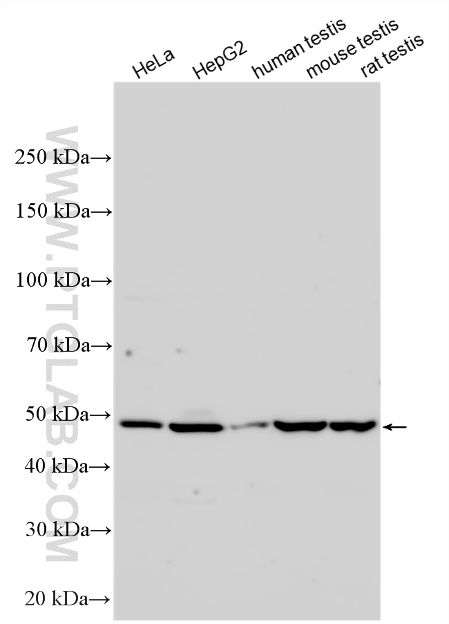 Various lysates were subjected to SDS PAGE followed by western blot with 25573-1-AP (ZNF689 antibody) at dilution of 1:3000 incubated at room temperature for 1.5 hours. WB analysis using 25573-1-AP