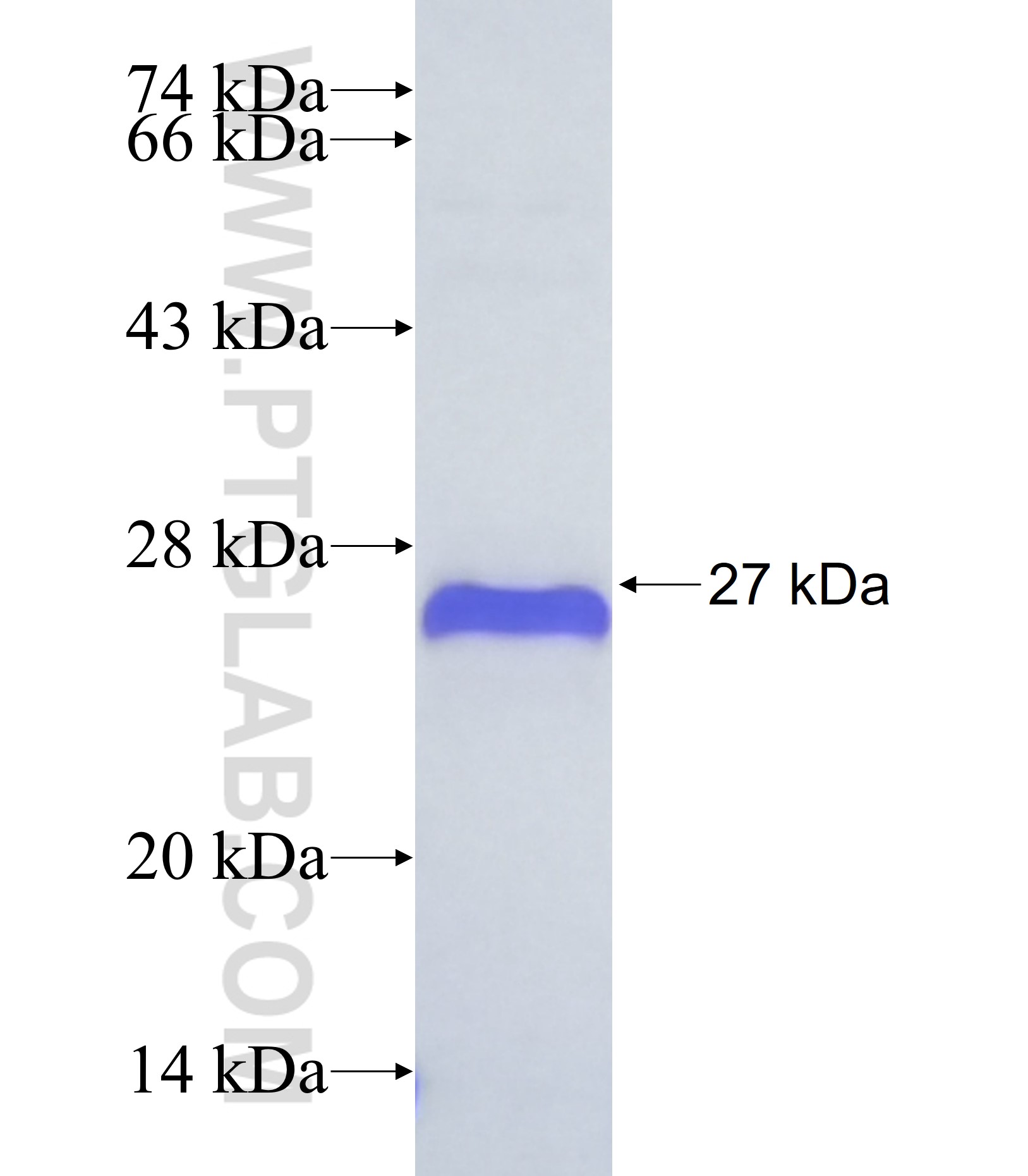 ZNF70 fusion protein Ag38019 SDS-PAGE ZNF70 fusion protein Ag38019 SDS-PAGE