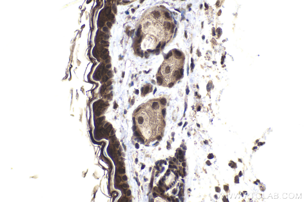IHC staining of mouse skin using 21075-1-AP