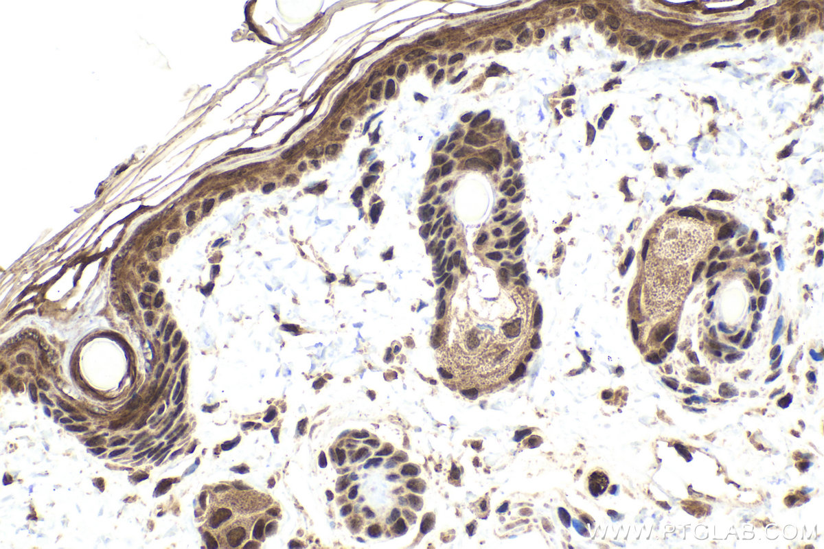 IHC staining of rat skin using 21075-1-AP