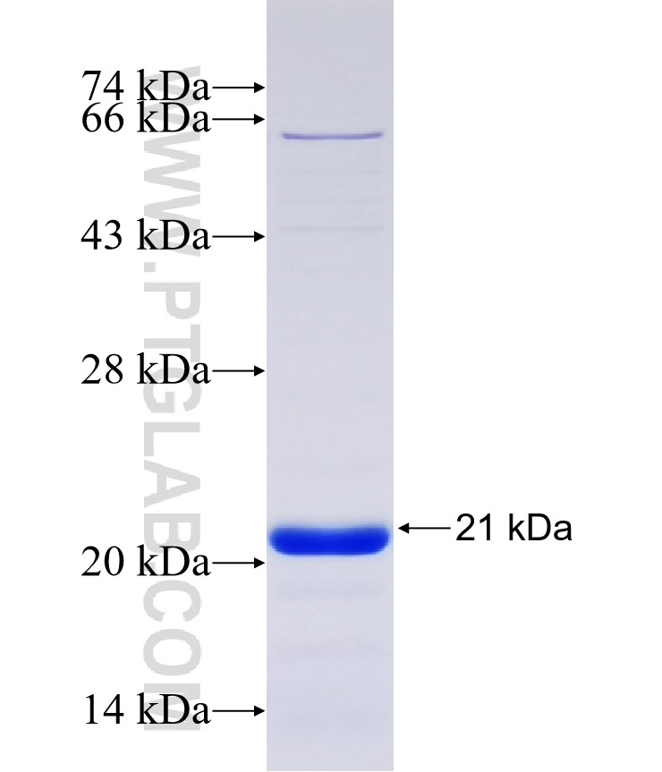 ZNF704 fusion protein Ag37028 SDS-PAGE ZNF704 fusion protein Ag37028 SDS-PAGE