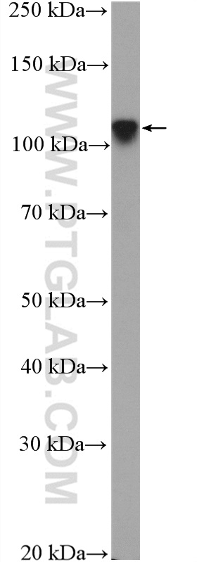 WB analysis of SKOV-3 using 25166-1-AP