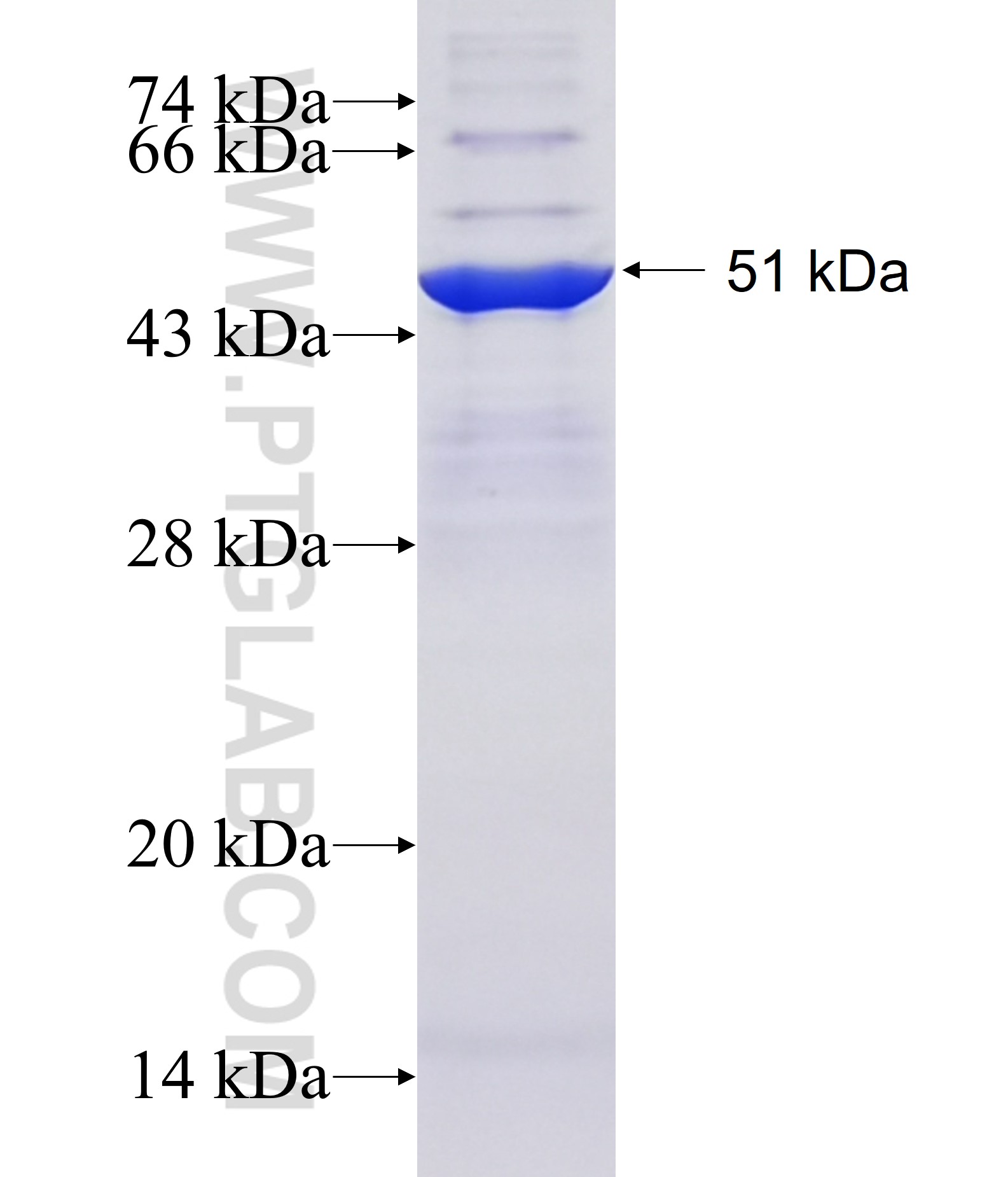 ZNF713 fusion protein Ag22349 SDS-PAGE ZNF713 fusion protein Ag22349 SDS-PAGE