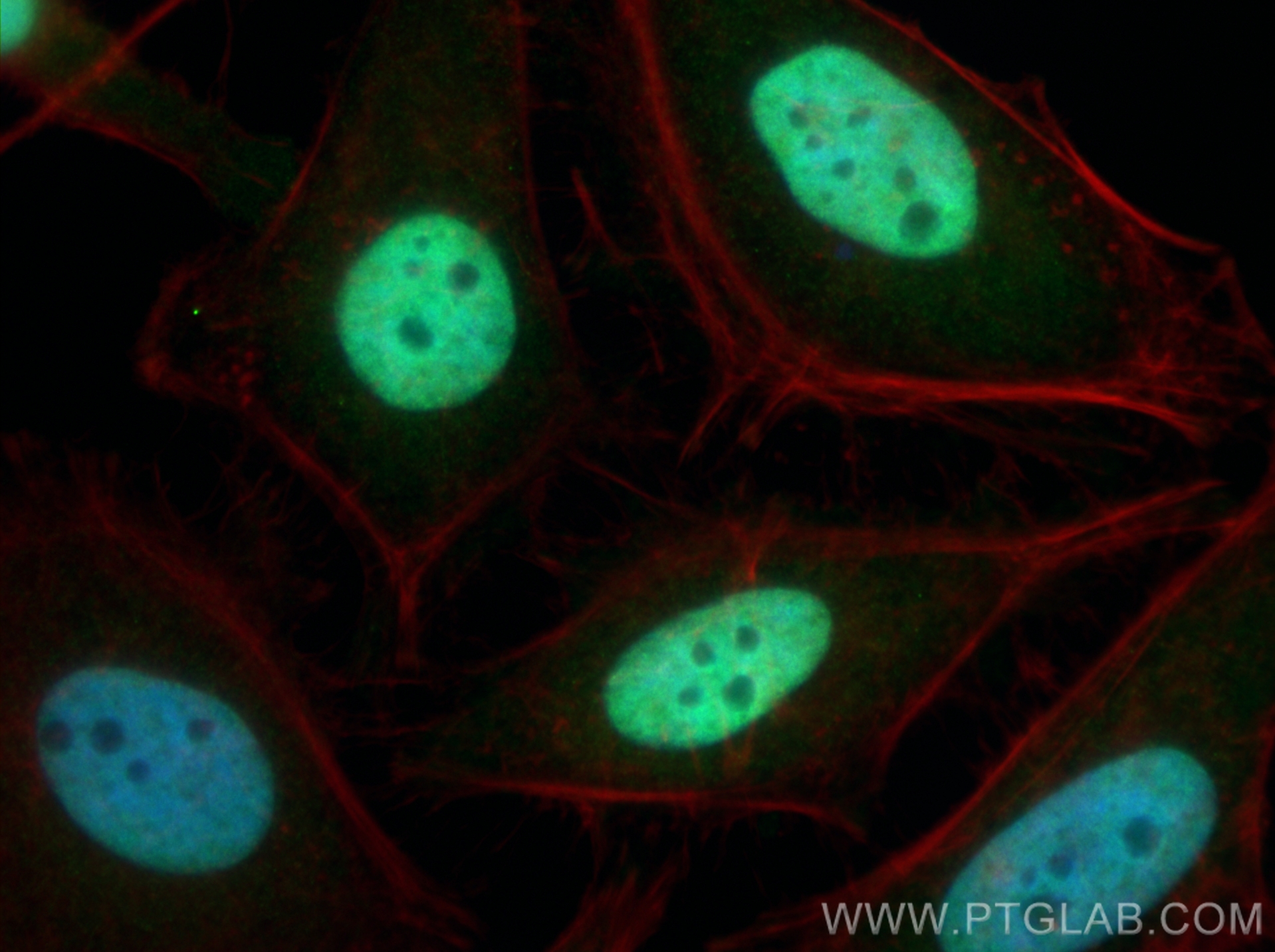 IF Staining of HeLa using 22074-1-AP
