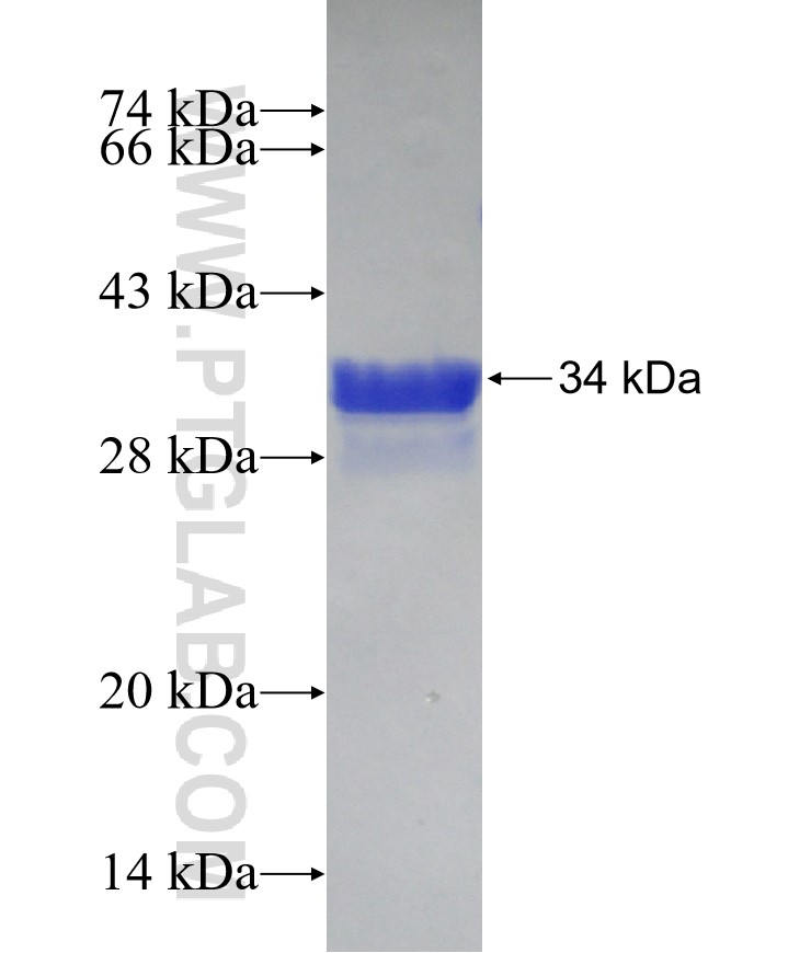 ZNF75D fusion protein Ag16139 SDS-PAGE