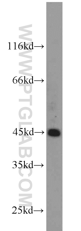 WB analysis of HeLa using 21922-1-AP