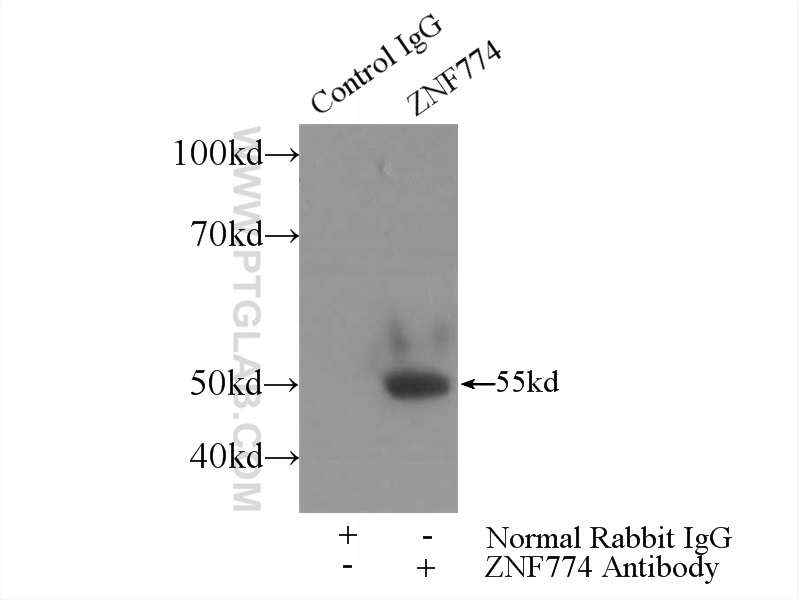 IP experiment of HepG2 using 25449-1-AP