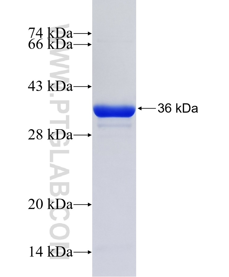 ZNF783 fusion protein Ag21744 SDS-PAGE
