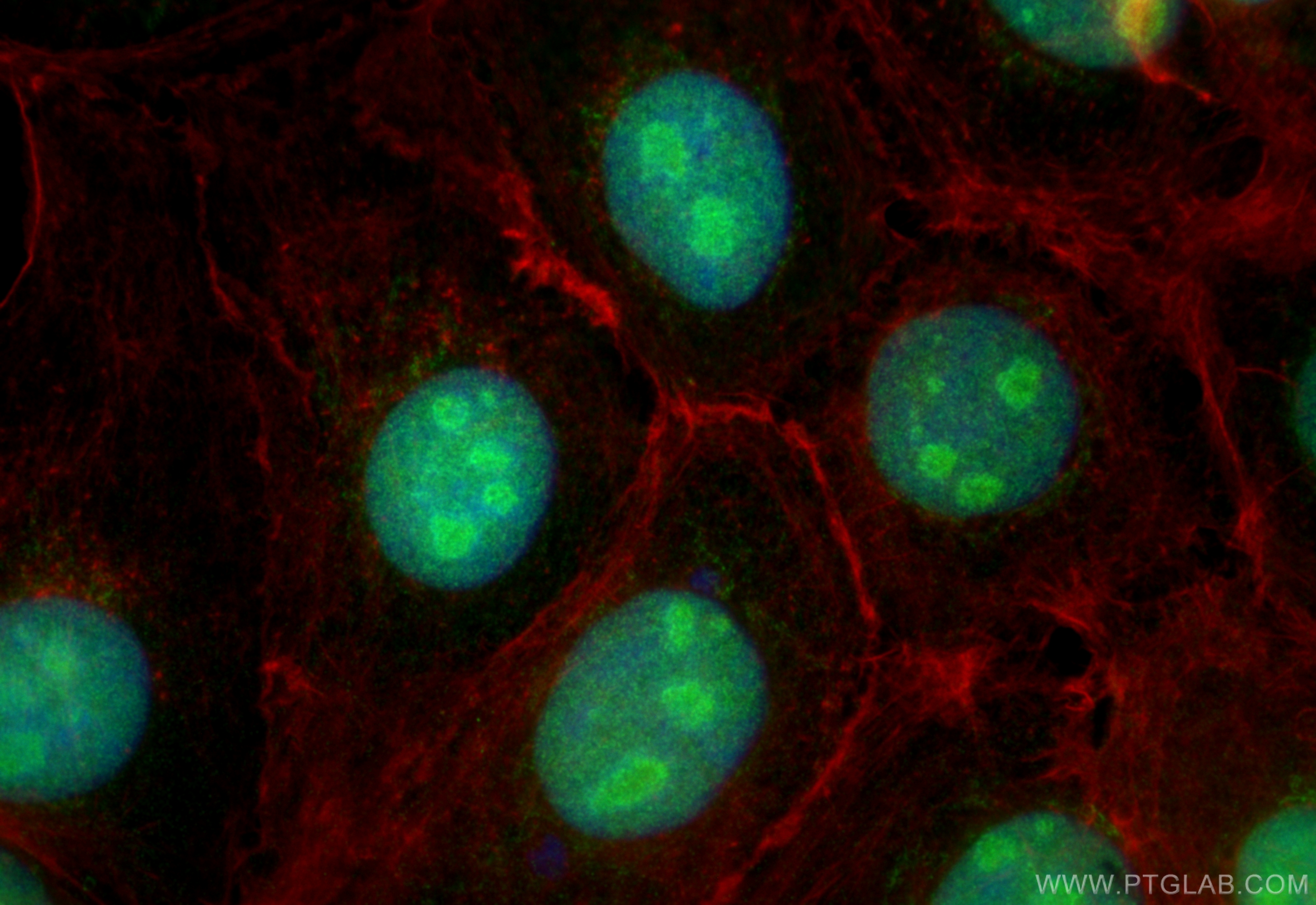 IF Staining of A431 using 31934-1-AP