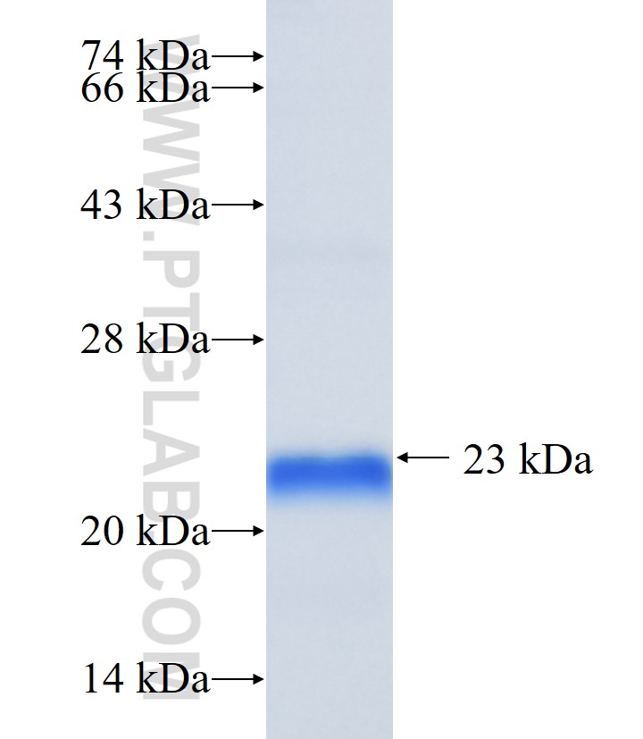 ZNF787 fusion protein Ag36078 SDS-PAGE ZNF787 fusion protein Ag36078 SDS-PAGE