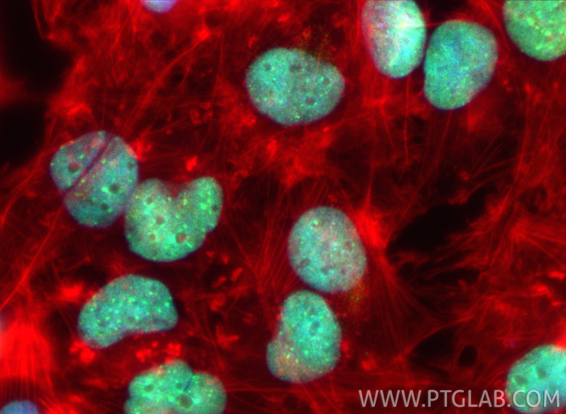 IF Staining of U-251 using 21221-1-AP