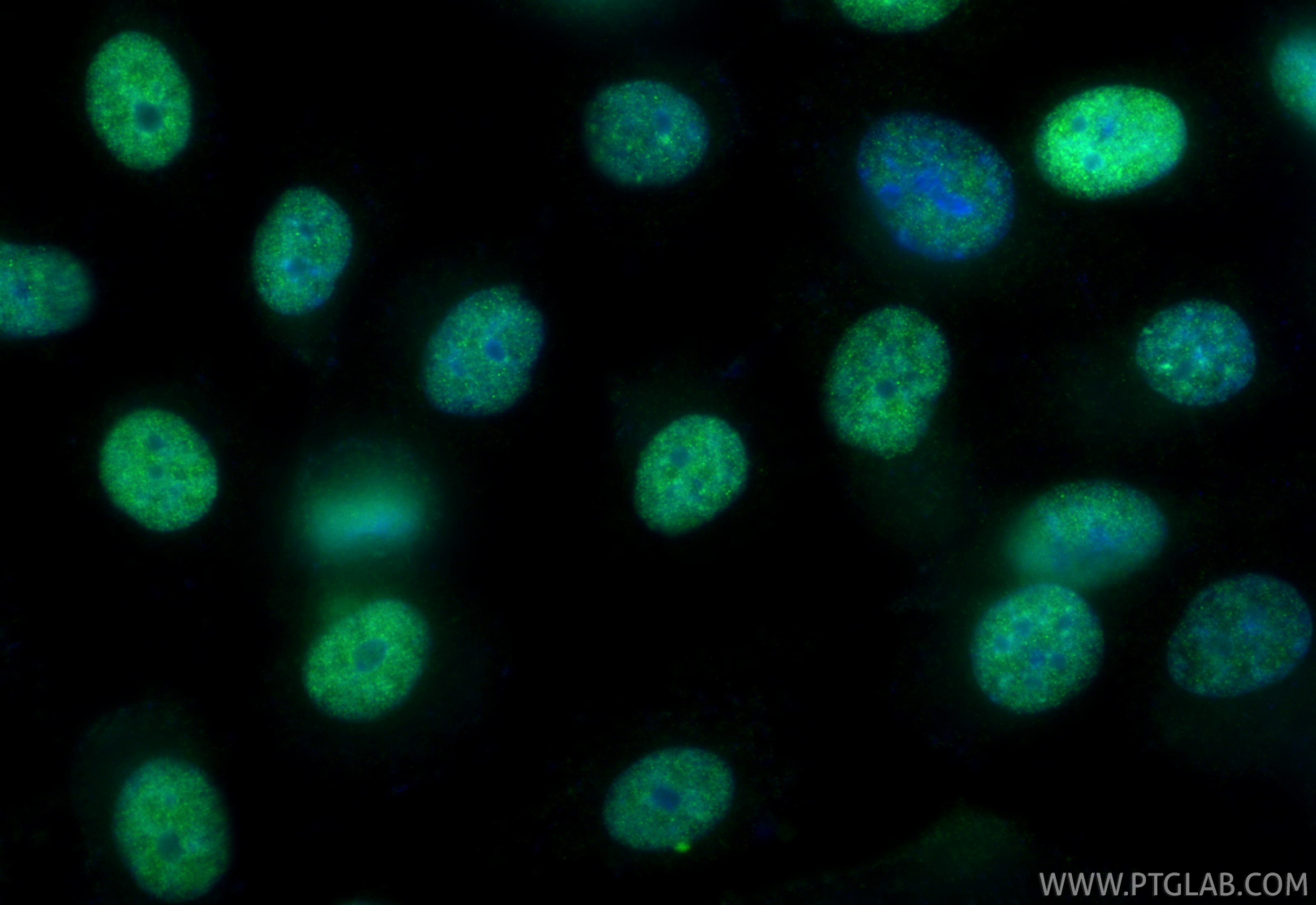 IF Staining of PC-3 using 21221-1-AP IF Staining of PC-3 using 21221-1-AP