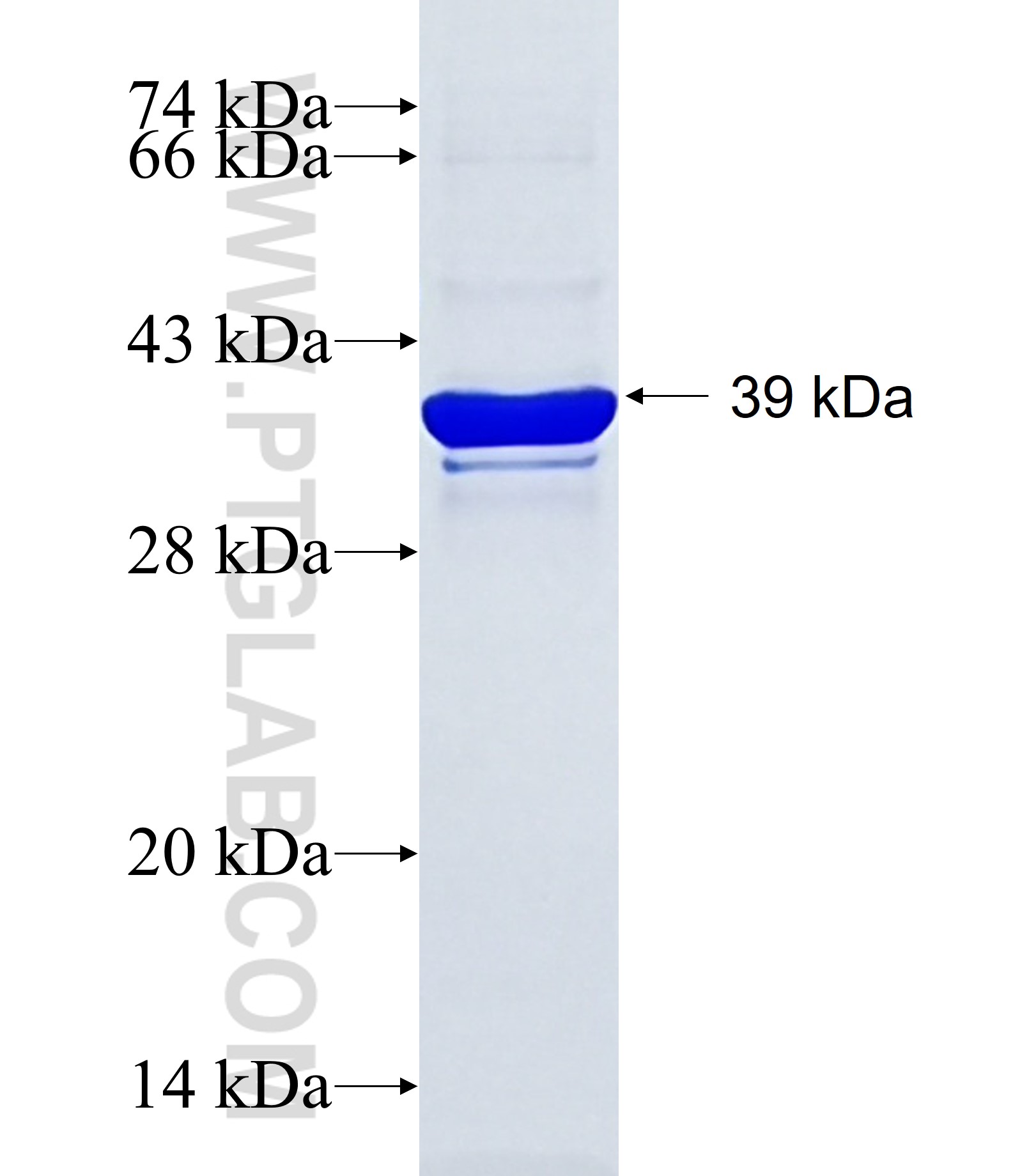ZNF816A fusion protein Ag15658 SDS-PAGE ZNF816A fusion protein Ag15658 SDS-PAGE