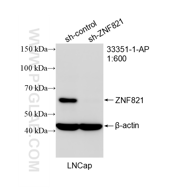 WB analysis of LNCaP using 33351-1-AP