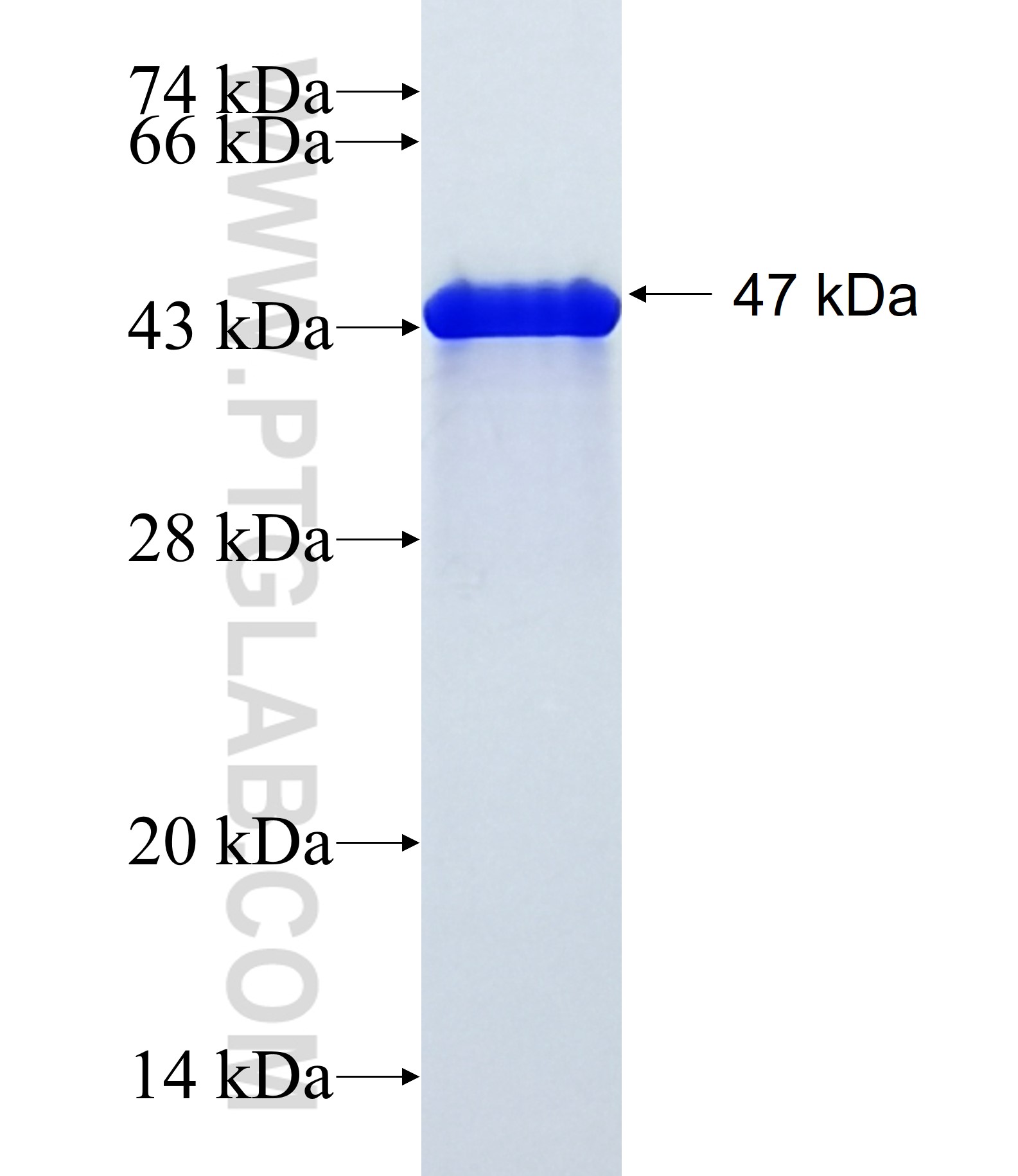 ZNF821 fusion protein Ag38977 SDS-PAGE ZNF821 fusion protein Ag38977 SDS-PAGE