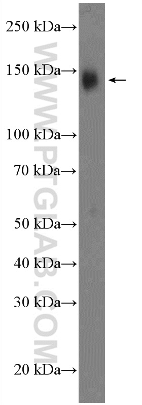 WB analysis of Jurkat using 26315-1-AP