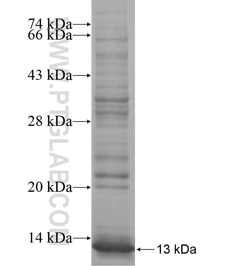 ZNF829 fusion protein Ag17324 SDS-PAGE ZNF829 fusion protein Ag17324 SDS-PAGE