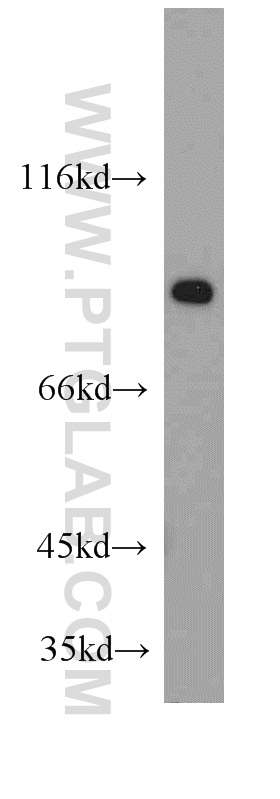 WB analysis of HeLa using 20539-1-AP