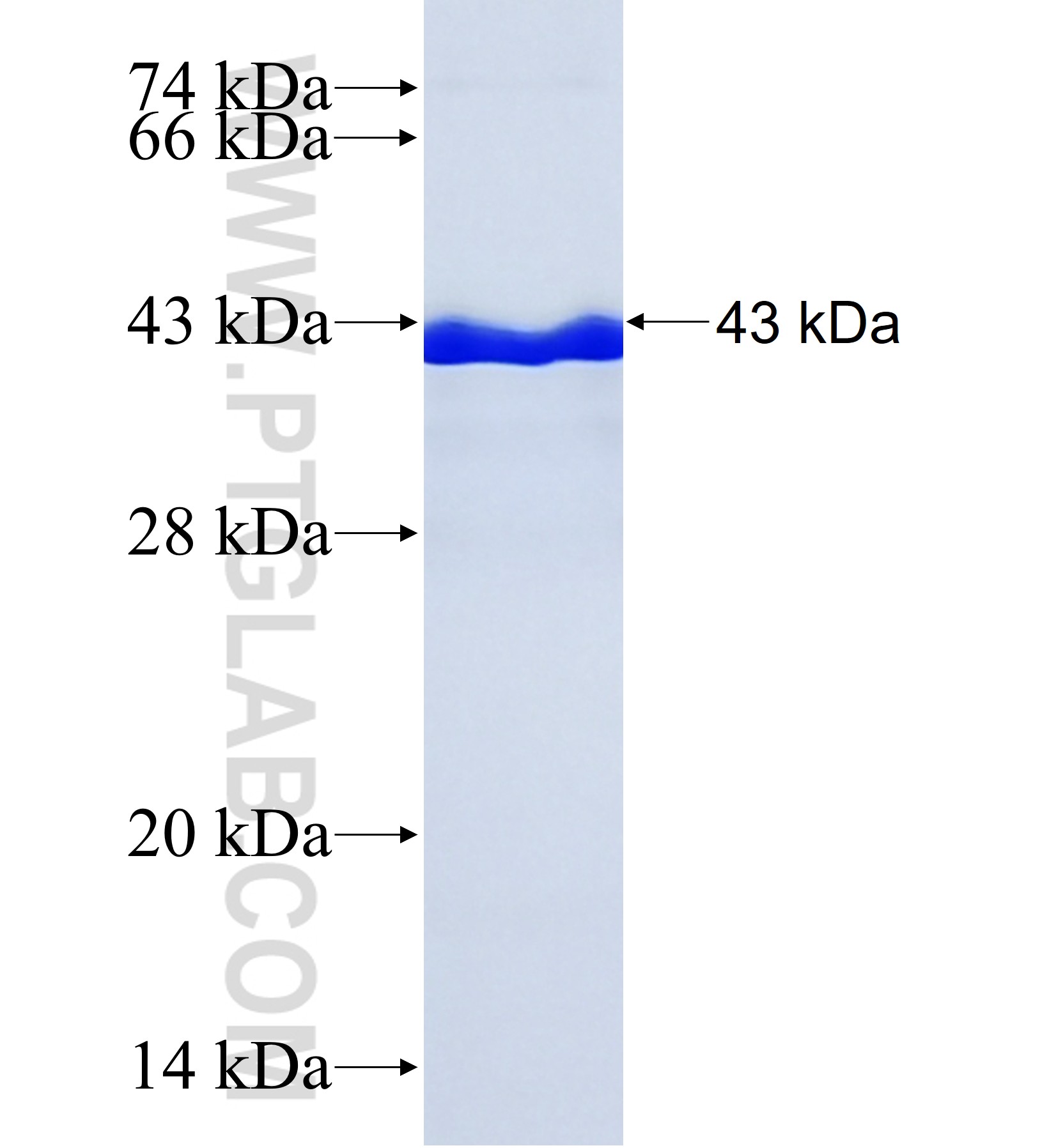 ZNF844 fusion protein Ag42049 SDS-PAGE ZNF844 fusion protein Ag42049 SDS-PAGE