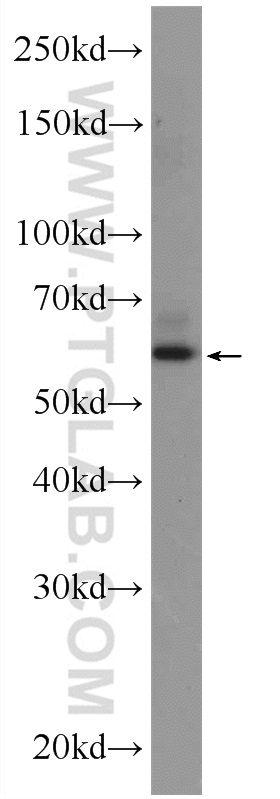 WB analysis of C6 using 24514-1-AP