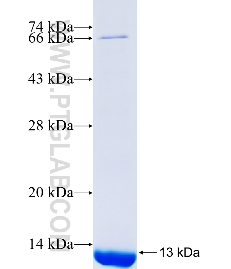 ZNF91 fusion protein Ag41366 SDS-PAGE ZNF91 fusion protein Ag41366 SDS-PAGE