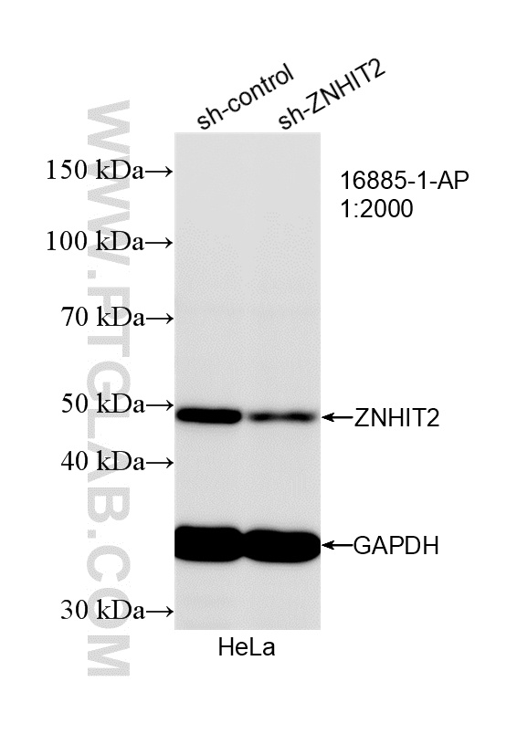 WB analysis of HeLa using 16885-1-AP