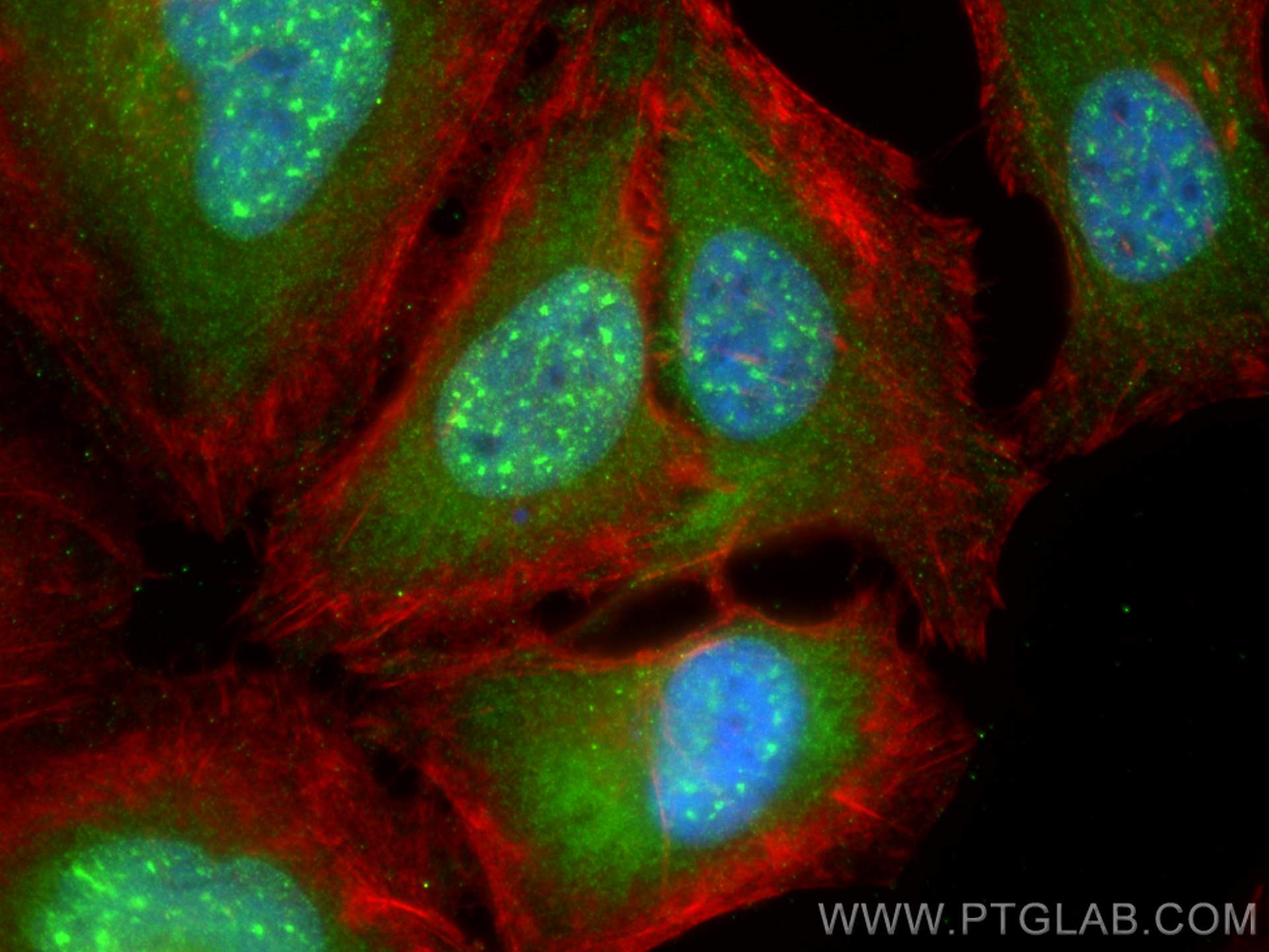 IF Staining of HeLa using 68331-1-Ig (same clone as 68331-1-PBS)