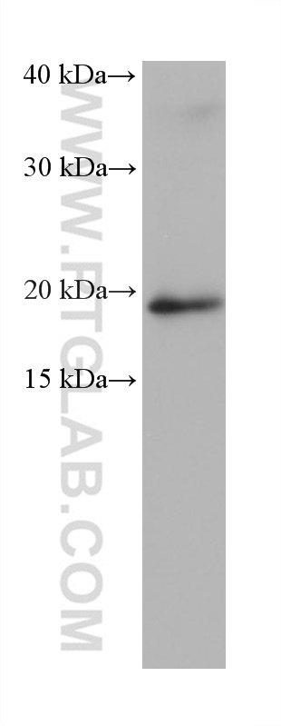 WB analysis of hTERT-RPE1 using 68331-1-Ig