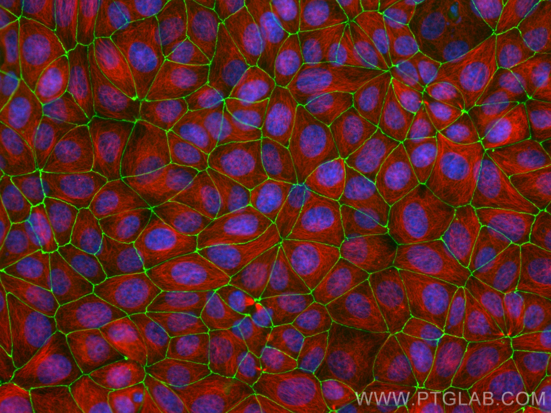 IF Staining of MCF-7 using CL488-82870-7