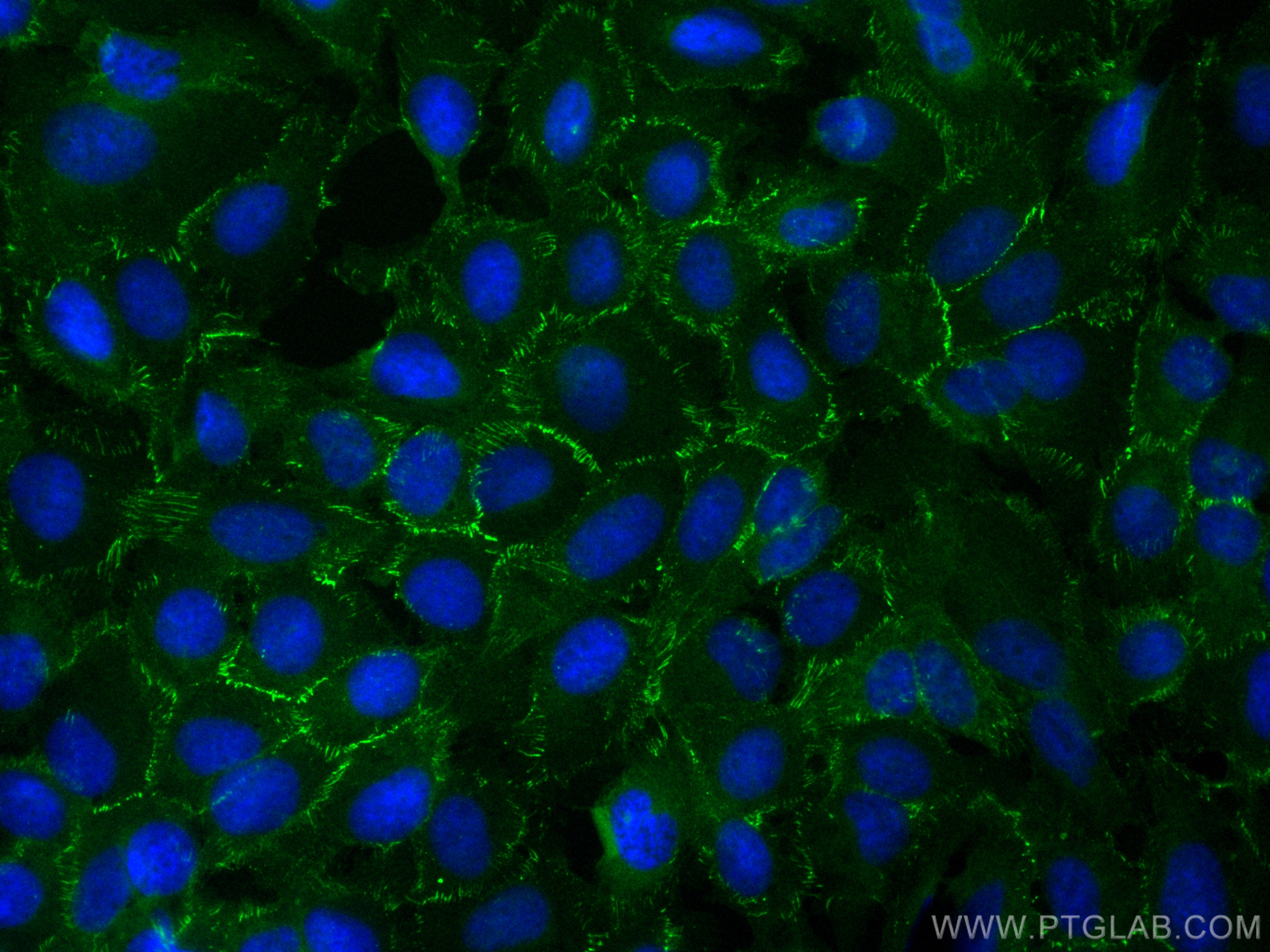 IF Staining of U2OS using CL488-82870