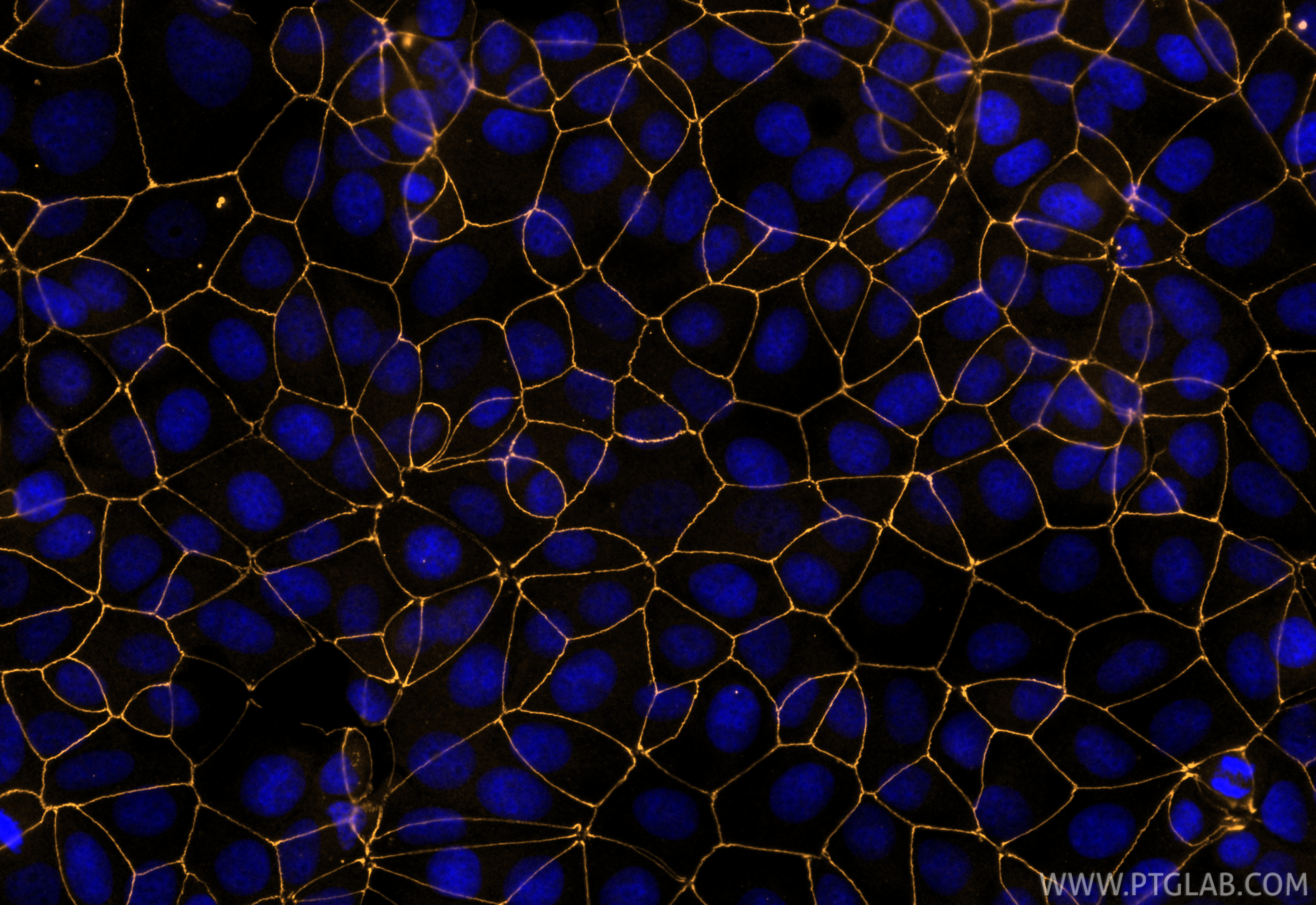 IF Staining of MCF-7 using CL555-82870-7
