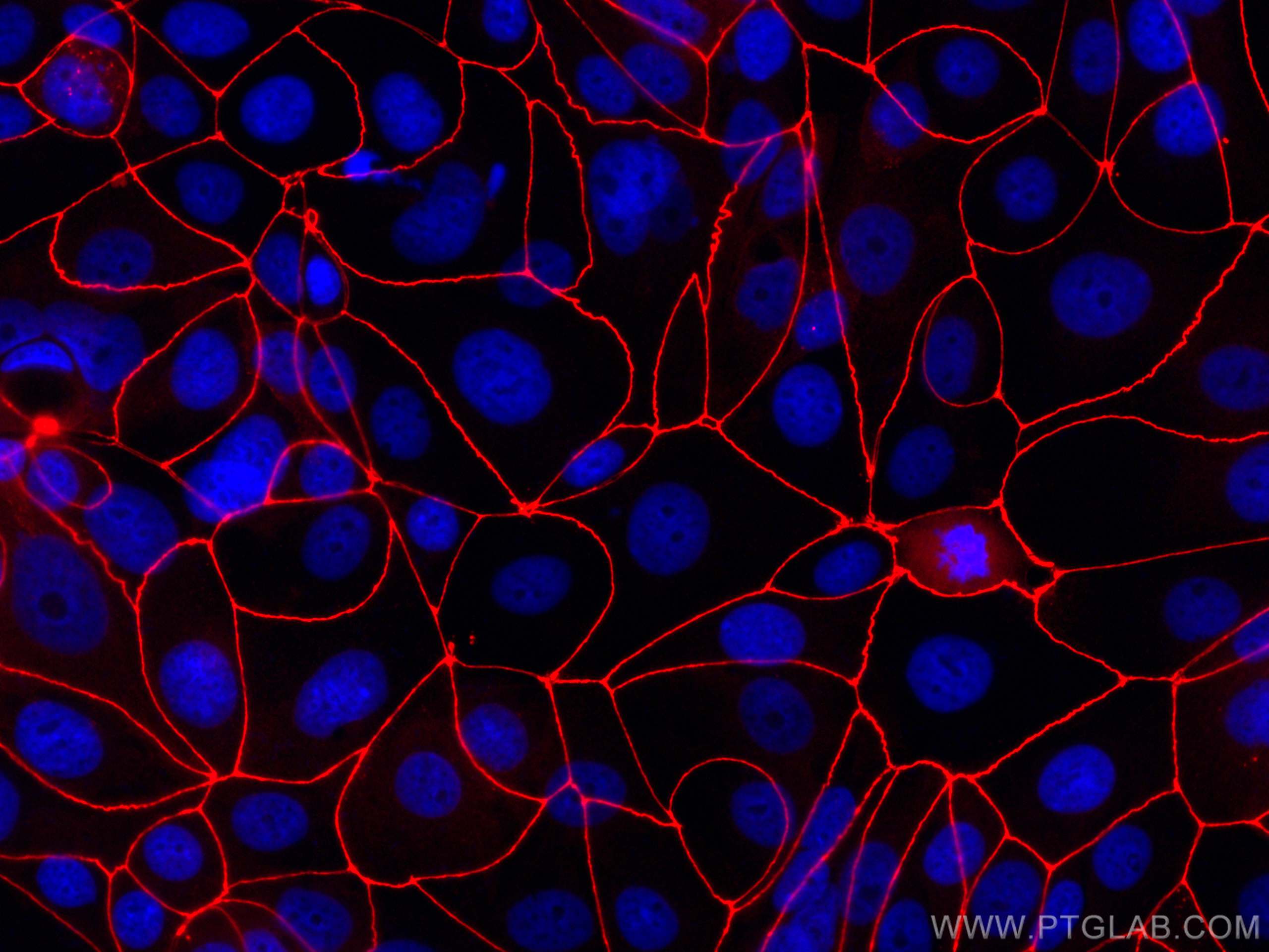 IF Staining of MCF-7 using CL594-21773