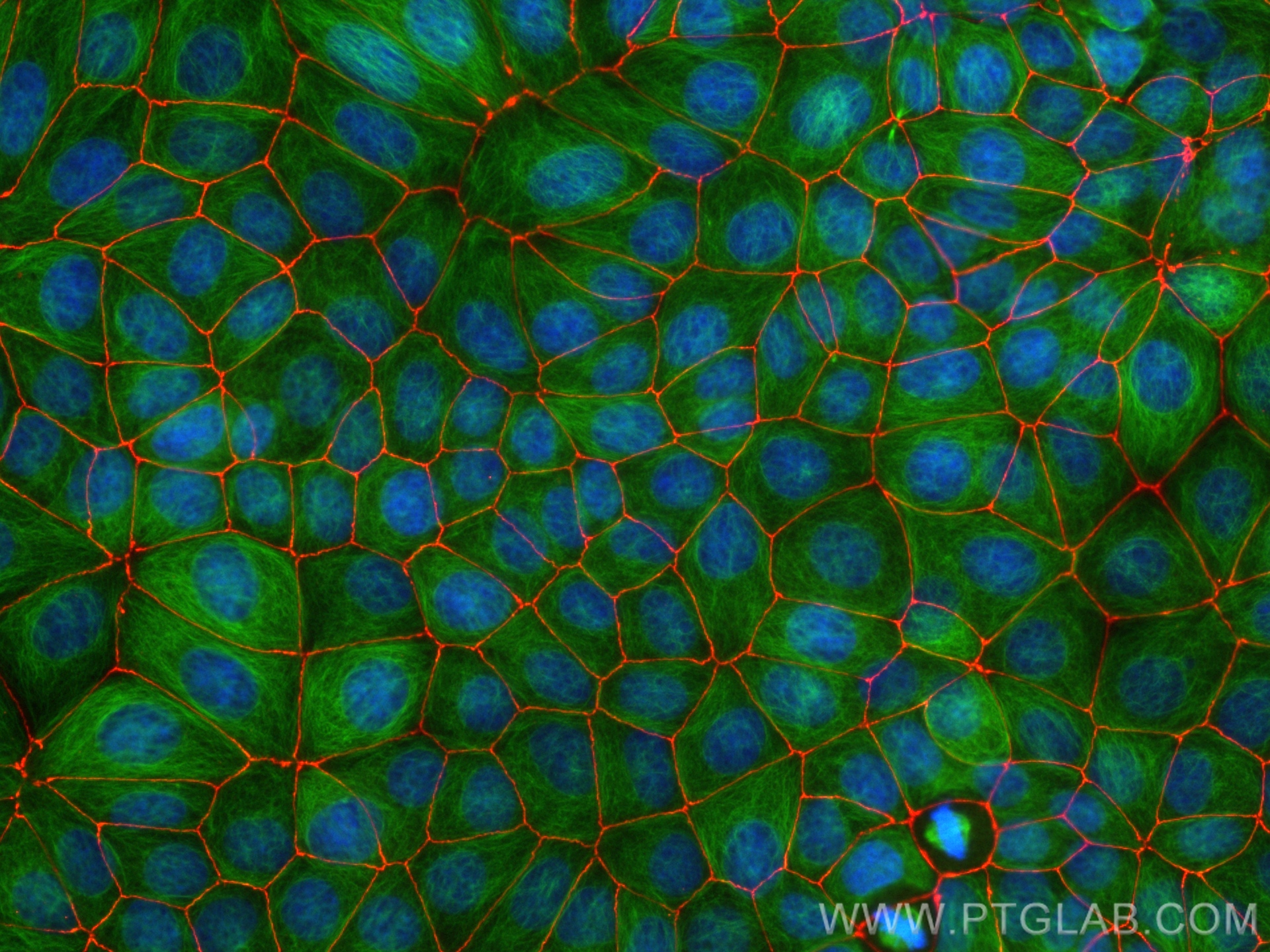 IF Staining of MCF-7 using CL594-82870-7