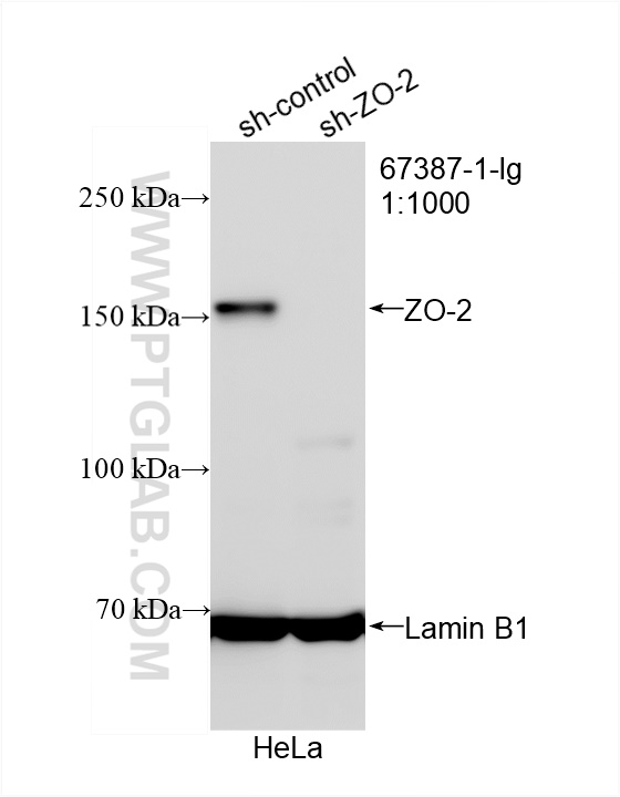 WB analysis of HeLa using 67387-1-Ig (same clone as 67387-1-PBS)